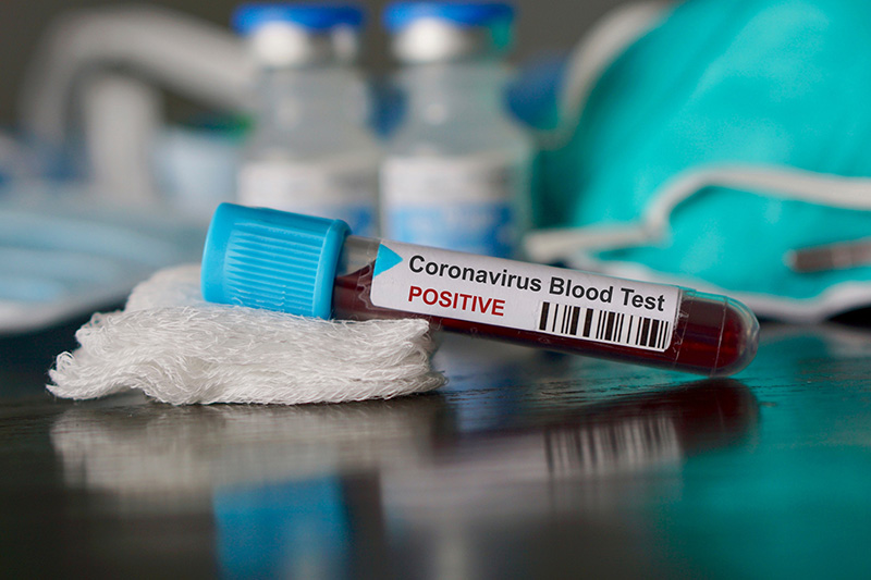Informações sobre o pós coronavírus no Canadá